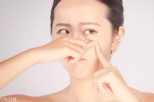 烟酰胺和水乳哪个先用 水乳和烟酰胺的顺序