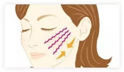 ​减肥后皮肤会松弛吗 减肥后怎样缓解皮肤松弛