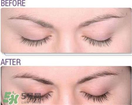 Rapidlash睫毛增长液好用吗?Rapidlash睫毛增长液怎么样? Rapidlash睫毛增长液好用吗?Rapidlash睫毛增长液怎么样?