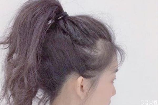 刚剪的刘海翘起来怎么办 为什么刘海老是悬空 刚剪的刘海翘起来怎么办 为什么刘海老是悬空