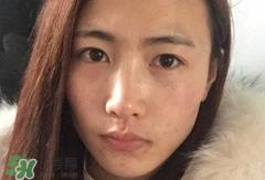 唇周边长痘是什么原因?唇周边长痘是怎么回事? 唇周边长痘是什么原因?唇周边长痘是怎么回事?