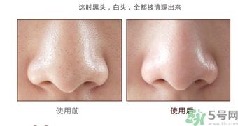 yu.r巧克力棒鼻贴怎么样？yu.r巧克力鼻贴好用吗？