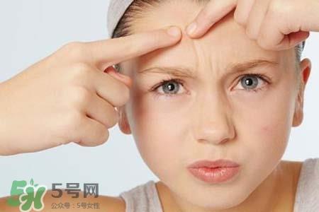 胶原蛋白能祛除痘印吗?胶原蛋白可以去痘坑吗? 胶原蛋白能祛除痘印吗?胶原蛋白可以去痘坑吗?