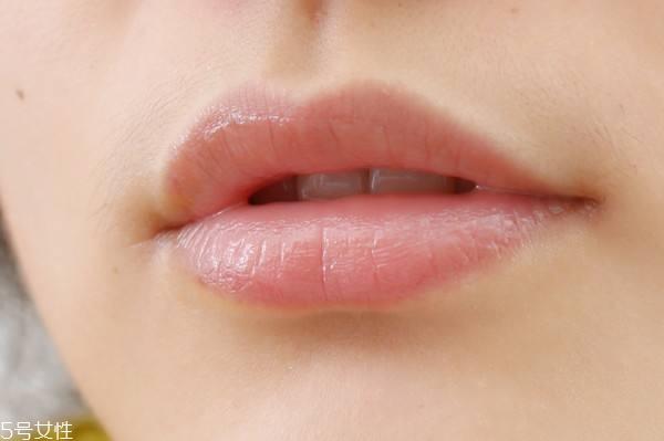 怎么去嘴唇角质 去嘴唇角质的方法