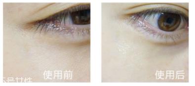 shangpree香蒲丽眼膜适合多大年龄?任何年龄 shangpree香蒲丽眼膜适合多大年龄?任何年龄