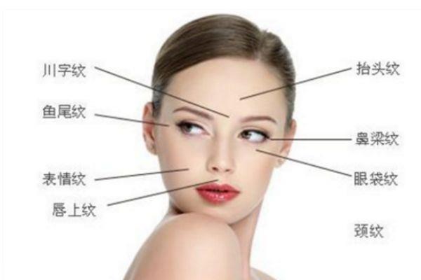 川字纹怎么消除 川字纹是什么 川字纹怎么消除 川字纹是什么