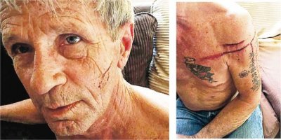 ​6旬老汉遭巨熊袭击：看破套路 挥拳击退