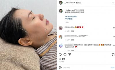 ​56岁李丽珍晒针灸瘦脸照，自嘲是肥珍！失恋后患抑郁症一度暴肥