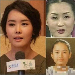 ​世界四大“邪术”之韩国整容术