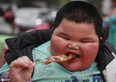 ​什么是小胖威利综合征？出现这些典型的外观特征，就得警惕了