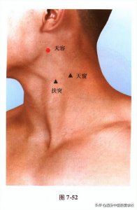 ​手太阳小肠经经穴——天容穴