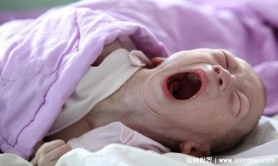 ​福岛核泄漏后产生的影响 怀孕女子产出辐射幽灵婴儿