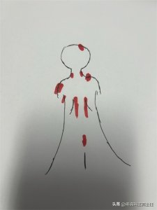 ​身体疼痛难受，找不到原因，警惕筋膜炎