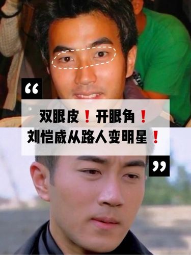 刘恺威整容前后，刘恺威五官,本文共（824字）