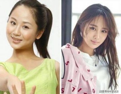 ​娄艺潇整容前后对比照：脸型五官变化一目了然