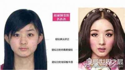 ​赵丽颖整容前后照片对比，整张脸完全不同了