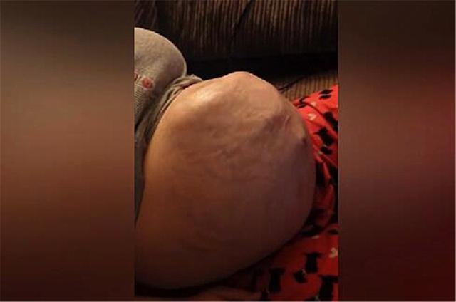 怀孕时胎动大是啥体验？相机记录下真实画面，网友：担心肚子破了