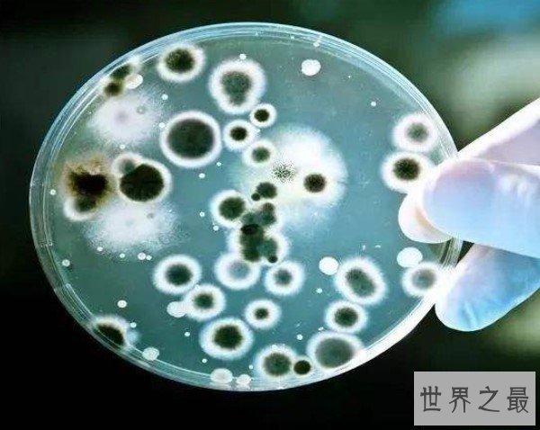 世界上细菌最多的水果,每个苹果携带的细菌高达1亿个