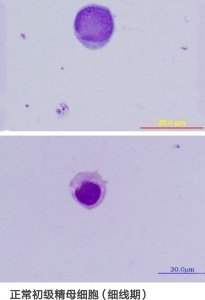 初识初级精母细胞