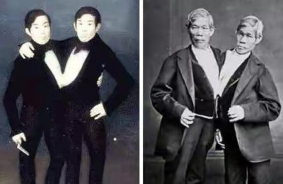 ​连体兄弟胸腔相连、共用肝脏，他们娶了一对亲姐妹，生下22个孩子
