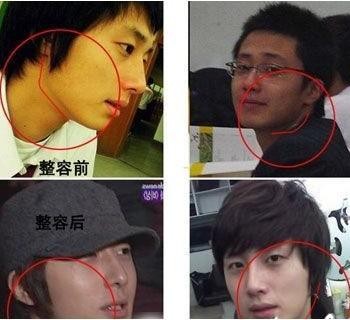 丁一宇整容前后,丫蛋蛋整容前后,本文共(504字) 丁一宇整容前后,丫蛋蛋整容前后,本文共(504字)